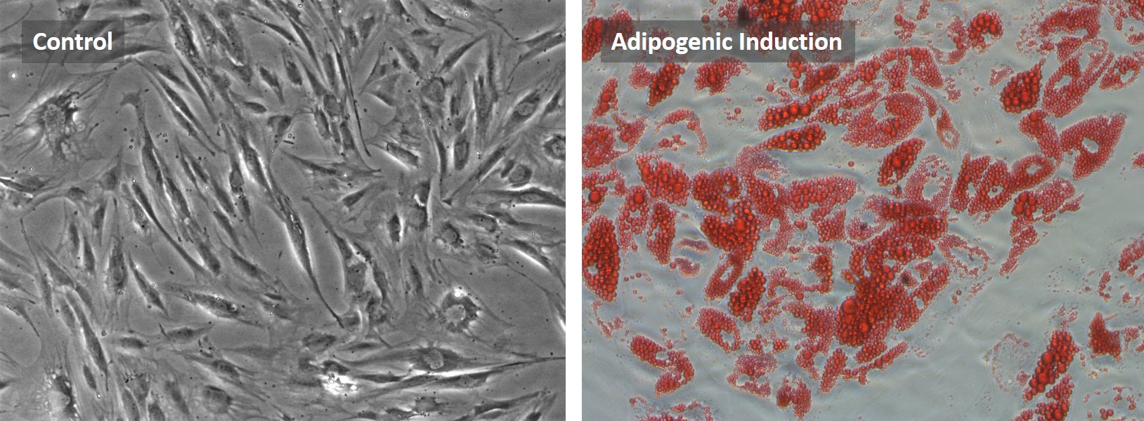 Adipogenic Induction