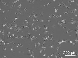 Human Pancreatic Stellate Cells