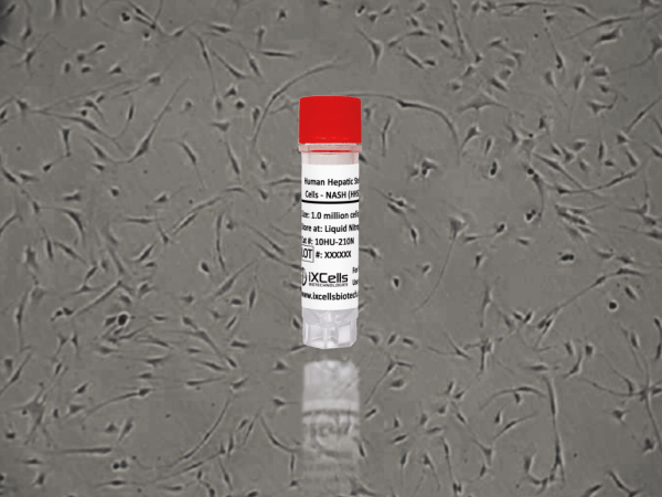 Human Hepatic Stellate Cells - NASH (HHSC -N)