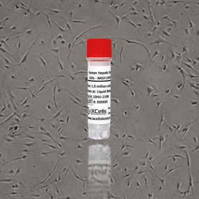 10HU-210N-Human Hepatic Stellate Cells – NASH (HHSC -N)