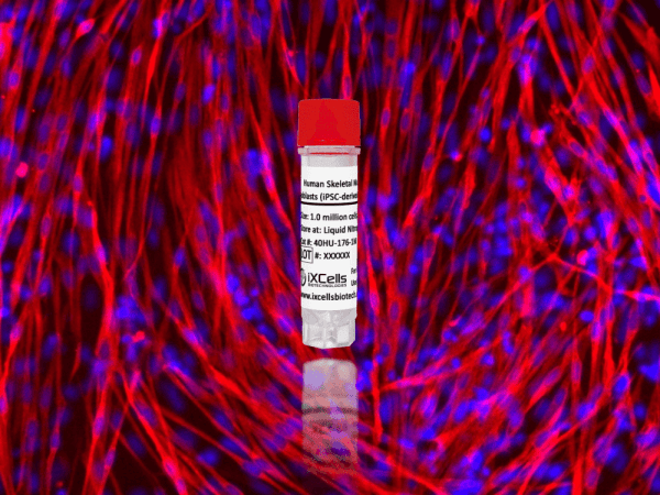 Human Skeletal Muscle Myoblasts (iPSC-derived, Normal)
