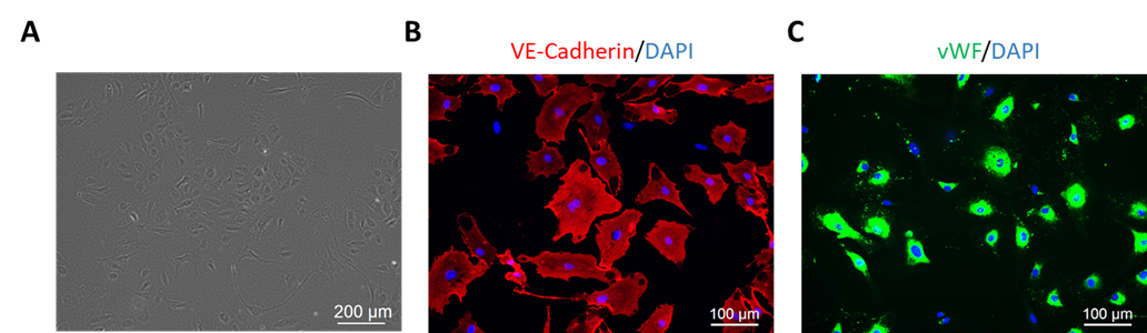 human glomerular microvascular endothelial cells