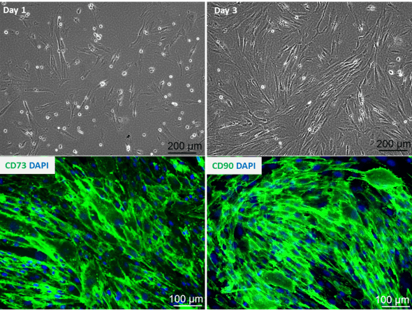Human Placental Mesenchymal Stem Cells Figure 1