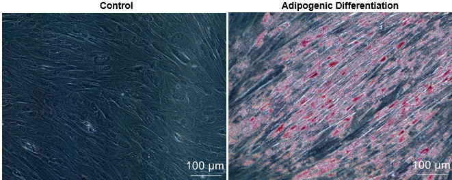 Human Placental Mesenchymal Stem Cells Figure 3