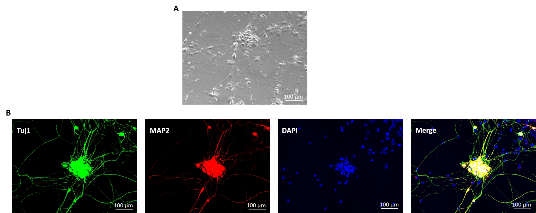 Rat Spinal Cord Motor Neuronsjpg