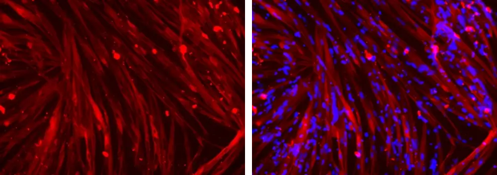 Myotubes