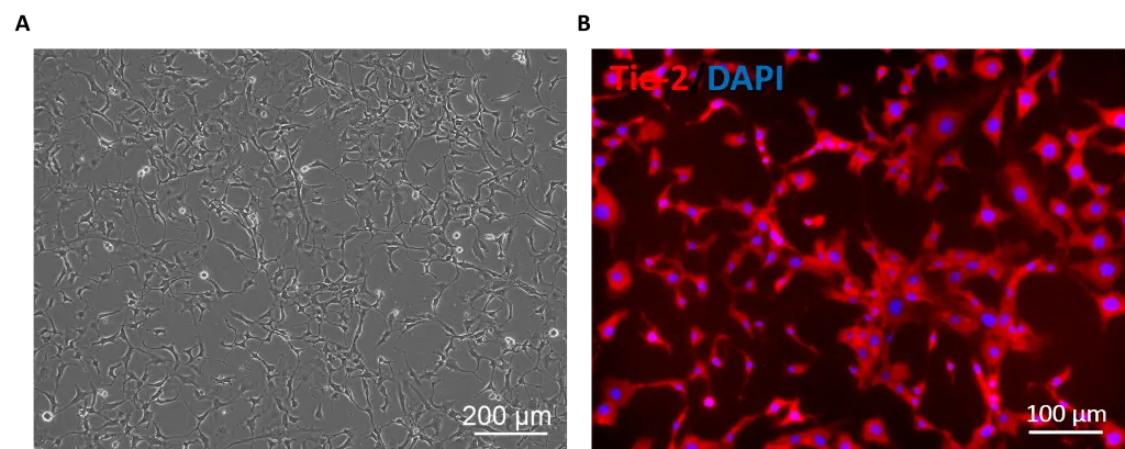 mouse pulmonary endothelial